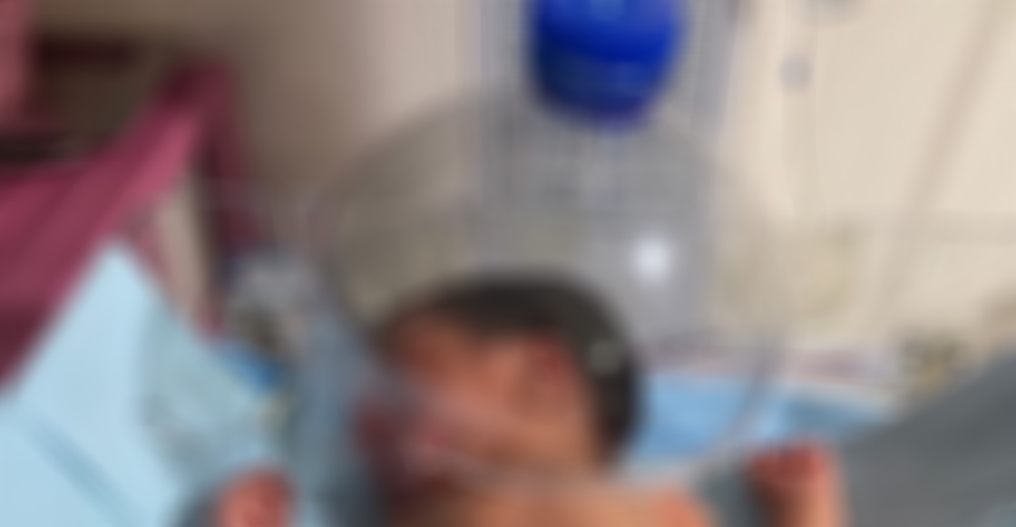 El caso del bebé salvado con una botella por falta de equipo en IMSS de Tabasco
